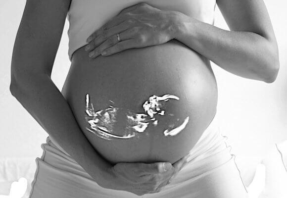 妊婦さんのお腹に赤ちゃんのエコー画像