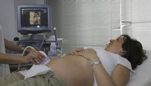 妊婦さんが超音波検査を受けている様子